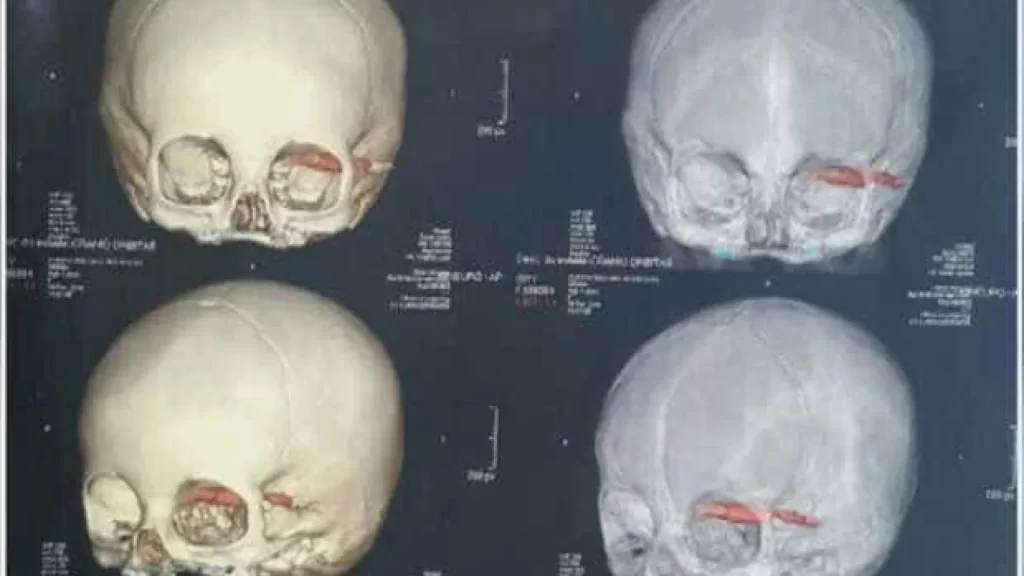 Cientistas acham crânios de 2.000 anos, e detalhe nos dentes chama atenção cientistas-acham-cranios-de-2.000-anos,-e-detalhe-nos-dentes-chama-atencao