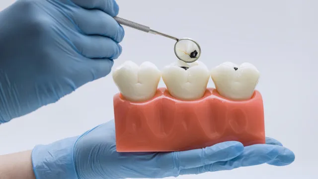Alimentos “inofensivos” podem destruir o esmalte dos dentes; veja alimentos-“inofensivos”-podem-destruir-o-esmalte-dos-dentes;-veja