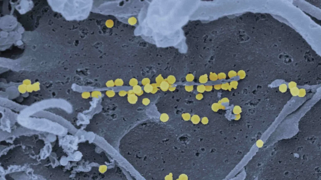 Surto de hantavírus não tem potencial pandêmico e risco global é baixo, diz OMS surto-de-hantavirus-nao-tem-potencial-pandemico-e-risco-global-e-baixo,-diz-oms
