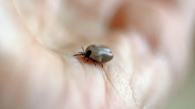 Mulher morre de febre maculosa no ABC; carrapatos foram encontrados em cães da vítima mulher-morre-de-febre-maculosa-no-abc;-carrapatos-foram-encontrados-em-caes-da-vitima
