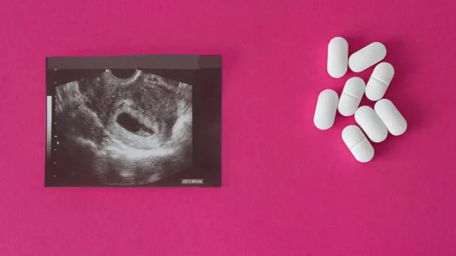 Metade das crianças grávidas com menos de 14 anos não recebe opção de aborto legal, diz pesquisa metade-das-criancas-gravidas-com-menos-de-14-anos-nao-recebe-opcao-de-aborto-legal,-diz-pesquisa